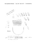 Orthodontic Archwire And Bracket System diagram and image