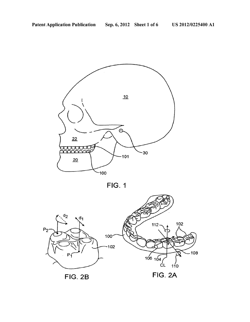 SYSTEM AND METHOD FOR POSITIONING TEETH - diagram, schematic, and image 02