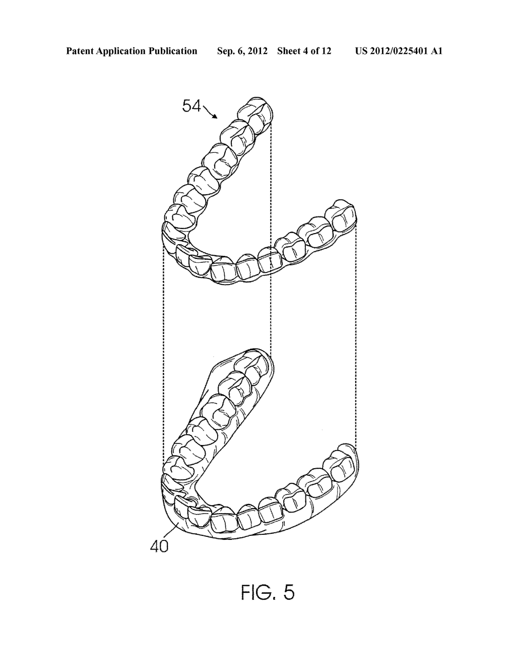 SYSTEM AND METHOD FOR DETECTING DEVIATIONS DURING THE COURSE OF AN     ORTHODONTIC TREATMENT TO GRADUALLY REPOSITION TEETH - diagram, schematic, and image 05