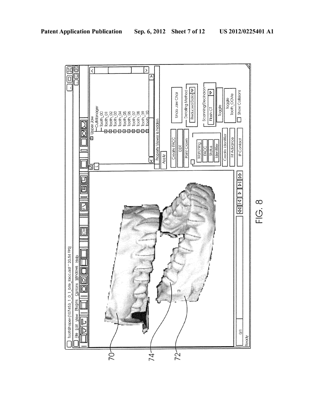 SYSTEM AND METHOD FOR DETECTING DEVIATIONS DURING THE COURSE OF AN     ORTHODONTIC TREATMENT TO GRADUALLY REPOSITION TEETH - diagram, schematic, and image 08