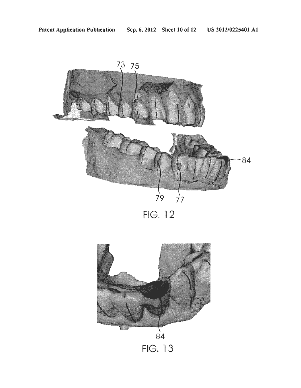 SYSTEM AND METHOD FOR DETECTING DEVIATIONS DURING THE COURSE OF AN     ORTHODONTIC TREATMENT TO GRADUALLY REPOSITION TEETH - diagram, schematic, and image 11