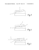 Method For Producing Individual Drilling Templates For Dental Implant     Surgery In A Patient s Jawbone diagram and image