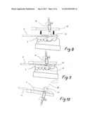 Method For Producing Individual Drilling Templates For Dental Implant     Surgery In A Patient s Jawbone diagram and image