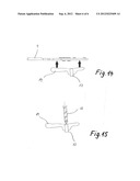 Method For Producing Individual Drilling Templates For Dental Implant     Surgery In A Patient s Jawbone diagram and image