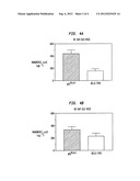 Cathepsin E as a Marker of Colon Cancer diagram and image