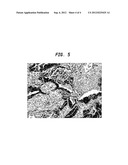 Cathepsin E as a Marker of Colon Cancer diagram and image