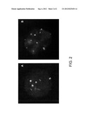 METHODS FOR DETECTING HUMAN PAPILLOMA VIRUS-ASSOCIATED CANCERS diagram and image