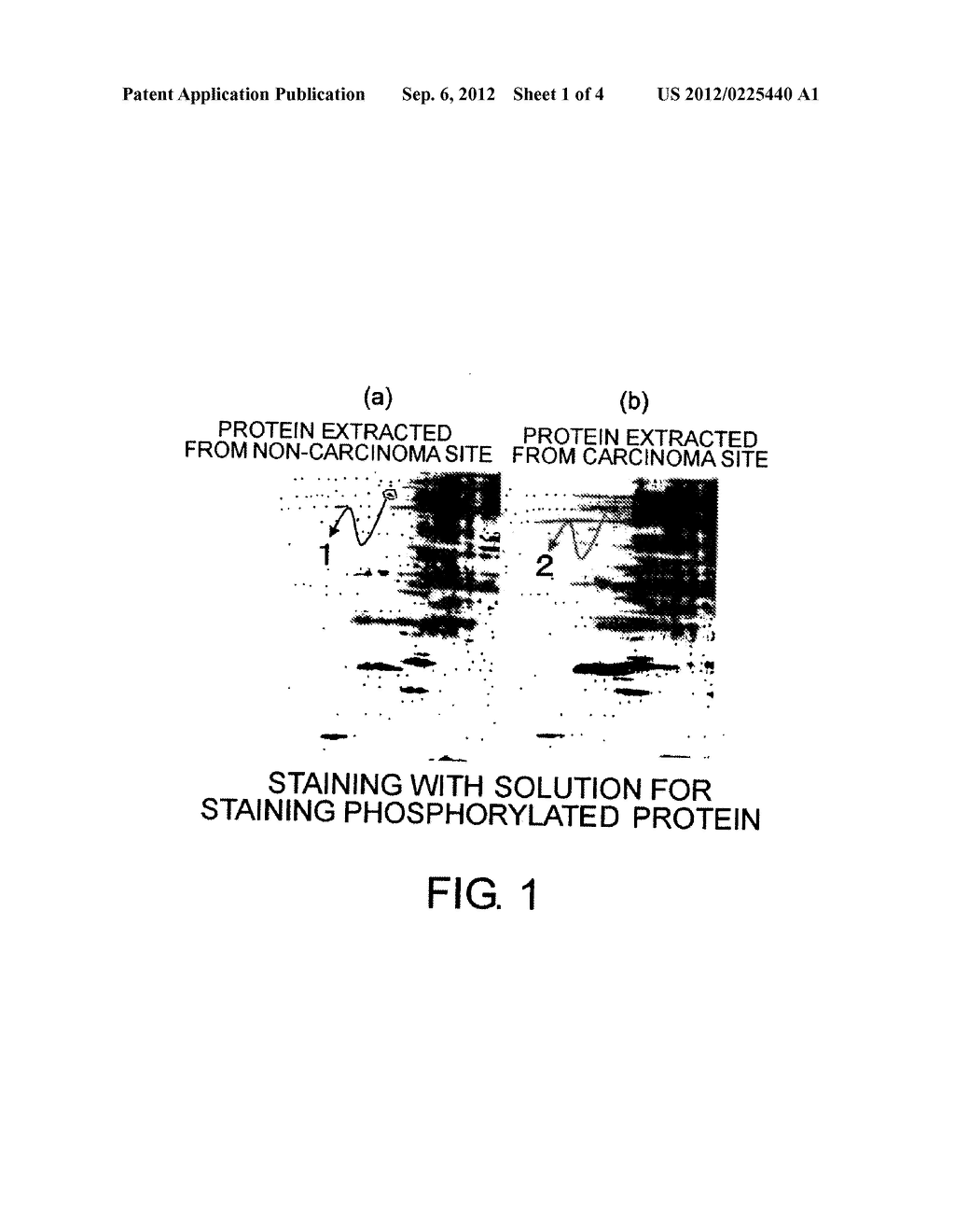 HEPATOCELLULAR CARCINOMA PROTEIN MARKER, AND METHOD FOR DETECTION OF     HEPATOCELLULAR CARCINOMA USING THE SAME - diagram, schematic, and image 02