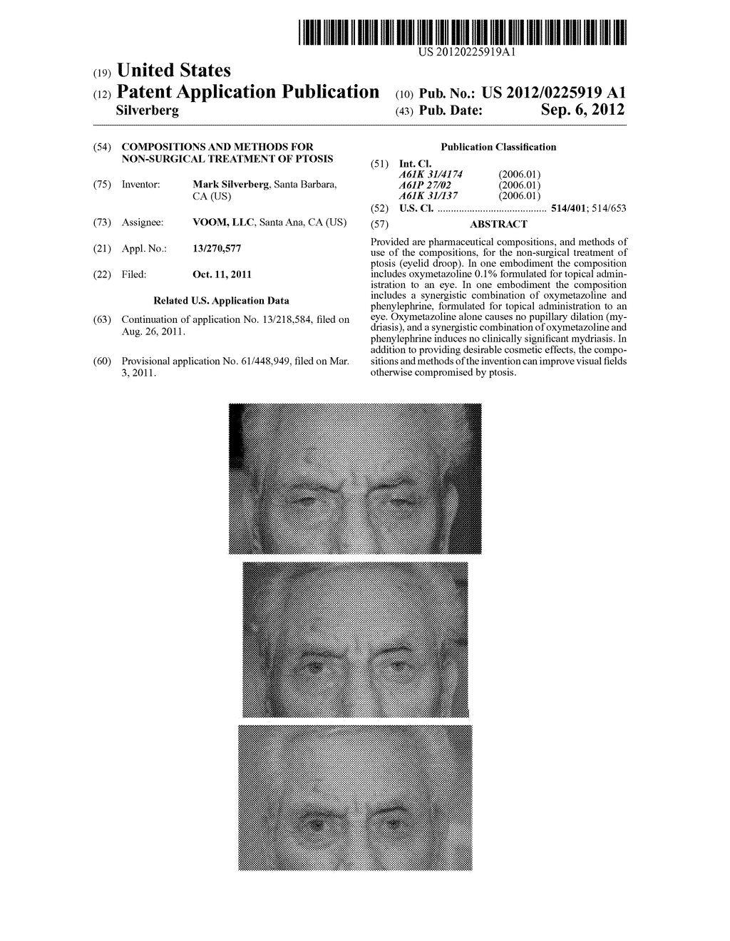 Compositions and Methods for Non-Surgical Treatment of Ptosis - diagram, schematic, and image 01