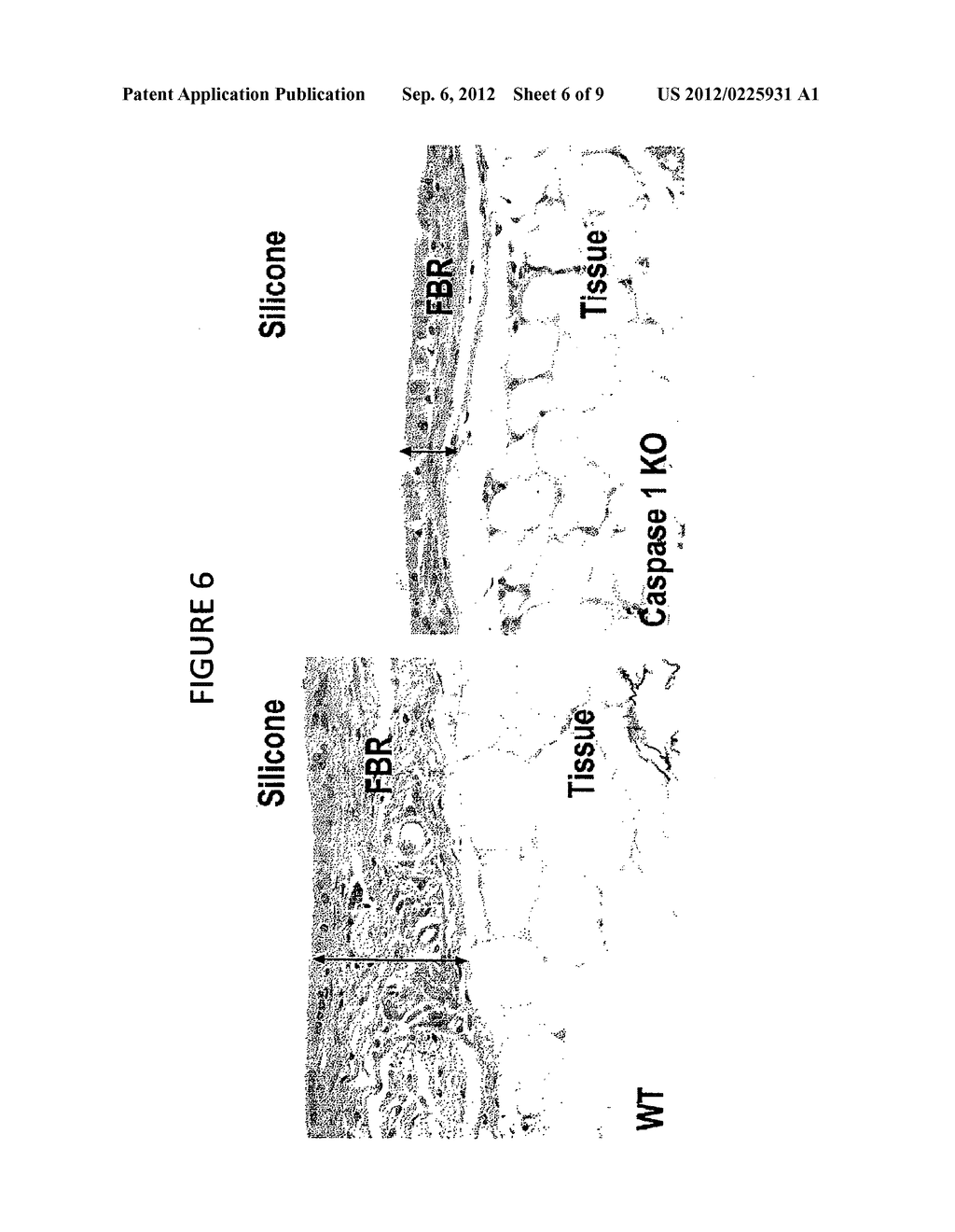 COMPOSITIONS AND METHODS FOR INHIBITING INFLAMMATION FROM AND REJECTION OF     BIOMATERIALS AND OTHER METHODS - diagram, schematic, and image 07