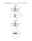 INTRA-SUBJECT MEDICAL SYSTEM, METHOD OF OPERATING BODY-INSERTABLE     APPARATUS AND OPERATIVE TREATMENT diagram and image