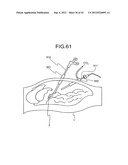 INTRA-SUBJECT MEDICAL SYSTEM, METHOD OF OPERATING BODY-INSERTABLE     APPARATUS AND OPERATIVE TREATMENT diagram and image