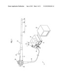 ENDOSCOPE diagram and image