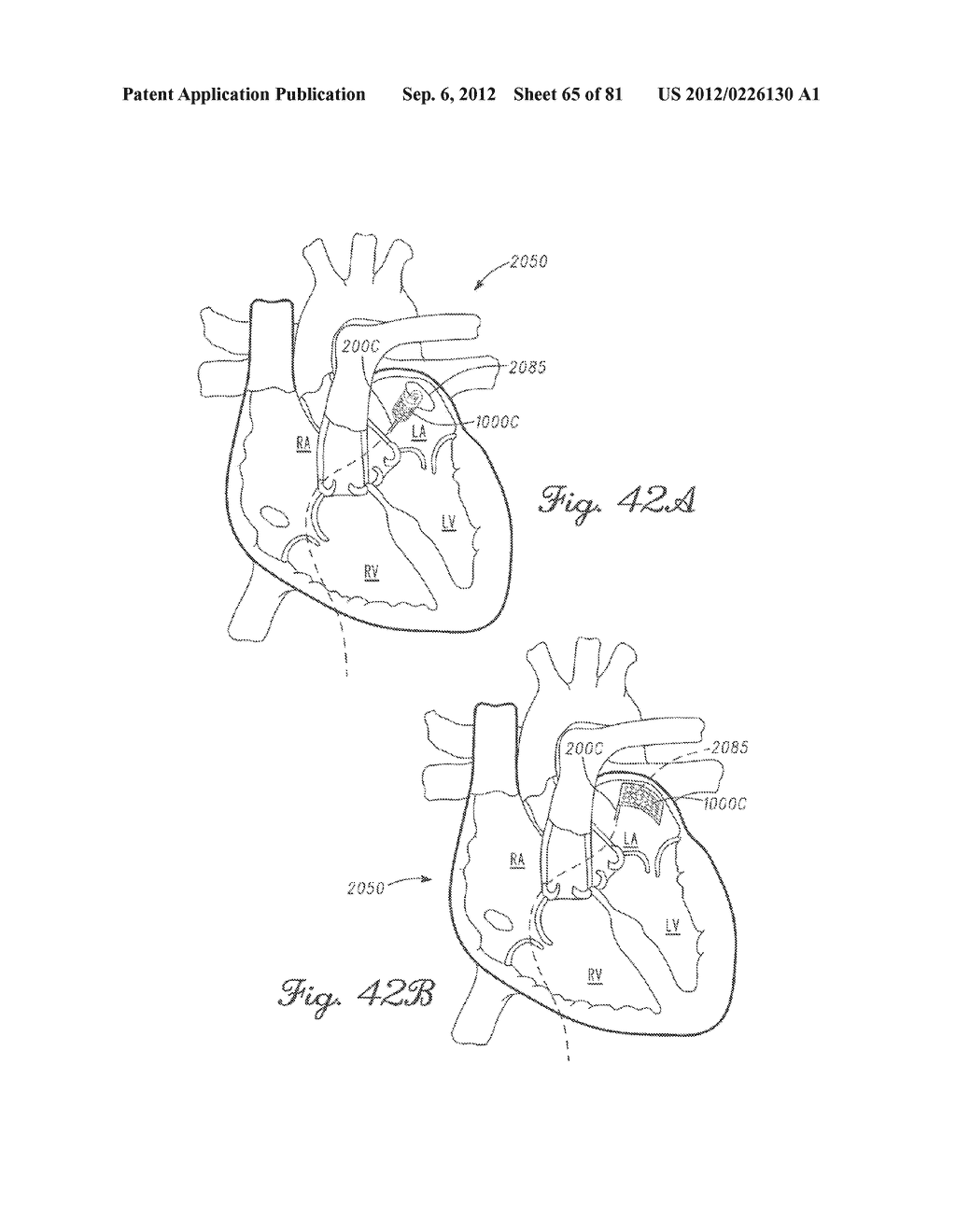 SYSTEMS, METHODS, AND DEVICES HAVING STRETCHABLE INTEGRATED CIRCUITRY FOR     SENSING AND DELIVERING THERAPY - diagram, schematic, and image 66