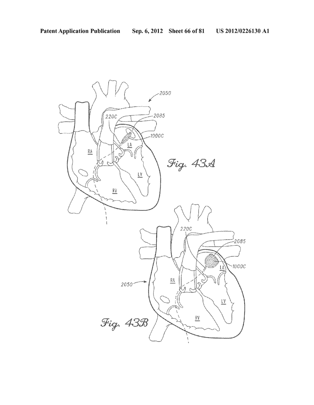 SYSTEMS, METHODS, AND DEVICES HAVING STRETCHABLE INTEGRATED CIRCUITRY FOR     SENSING AND DELIVERING THERAPY - diagram, schematic, and image 67