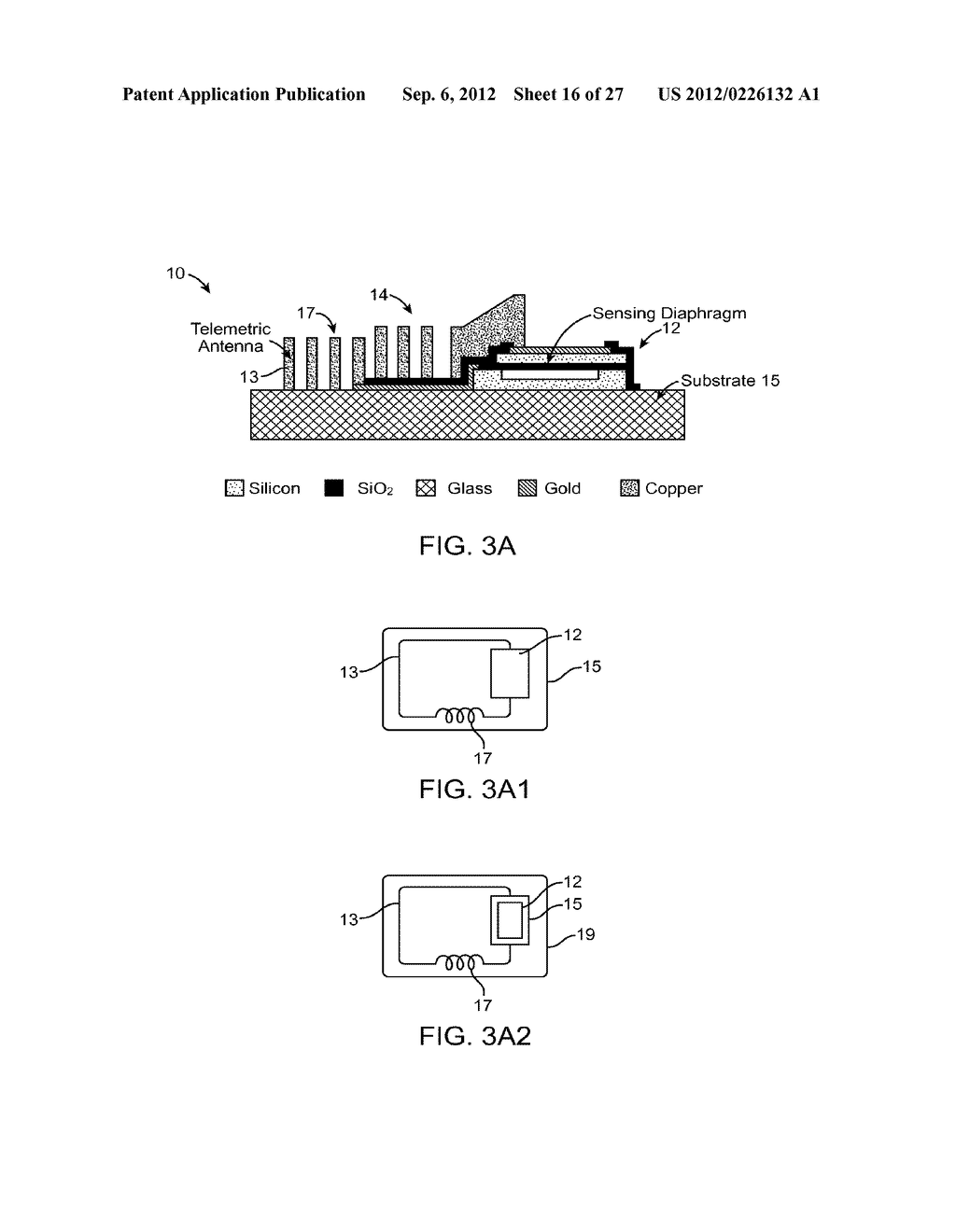 IMPLANTABLE OPHTHALMIC MEMS SENSOR DEVICES AND METHODS FOR EYE SURGERY - diagram, schematic, and image 17