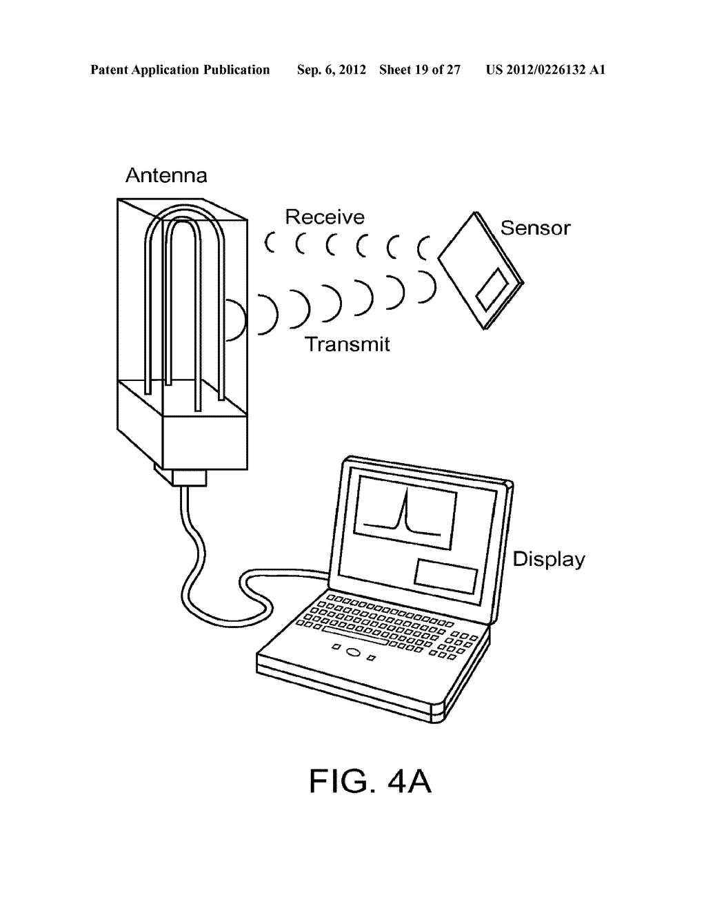 IMPLANTABLE OPHTHALMIC MEMS SENSOR DEVICES AND METHODS FOR EYE SURGERY - diagram, schematic, and image 20