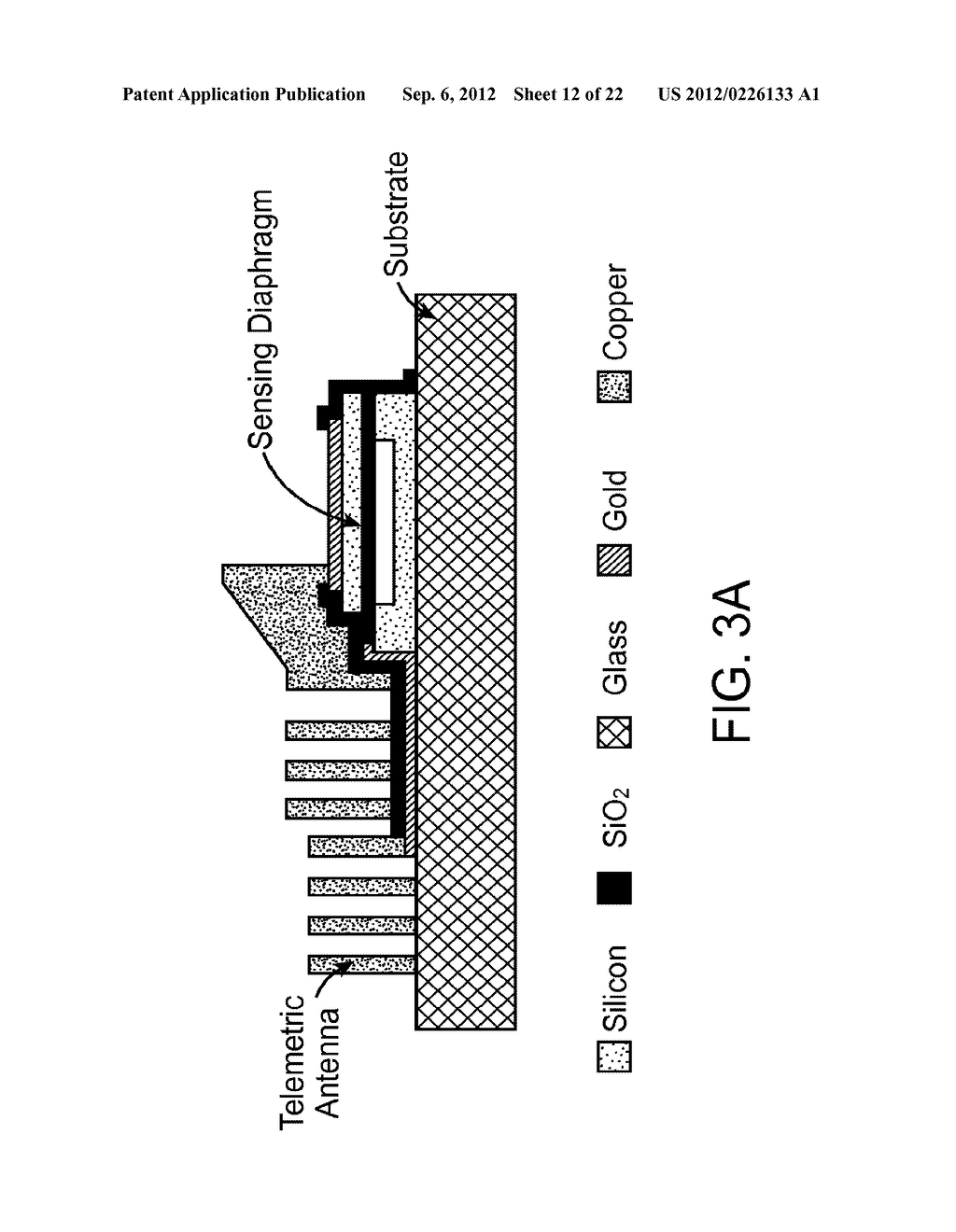 IMPLANTABLE MEMS INTRAOCULAR PRESSURE SENSOR DEVICES AND METHODS FOR     GLAUCOMA MONITORING - diagram, schematic, and image 13