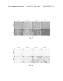 METHODS AND DEVICES OF DETECTION, GRADING, MONITORING, AND FOLLOW-UP OF     FIBROSIS diagram and image