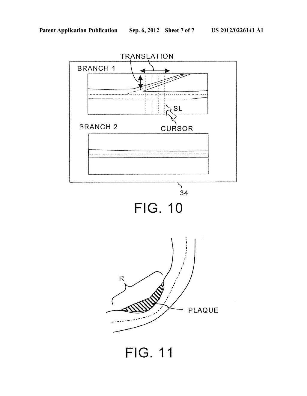 MAGNETIC RESONANCE IMAGING APPARATUS AND MAGNETIC RESONANCE IMAGING METHOD - diagram, schematic, and image 08