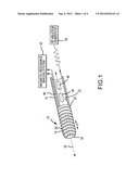 CATHETER ELECTRODE THAT CAN SIMULTANEOUSLY EMIT ELECTRICAL ENERGY AND     FACILITATE VISUALIZATION BY MAGNETIC RESONANCE IMAGING diagram and image