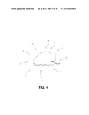 DEPLOYABLE MARKER AND METHOD FOR DEPLOYMENT diagram and image