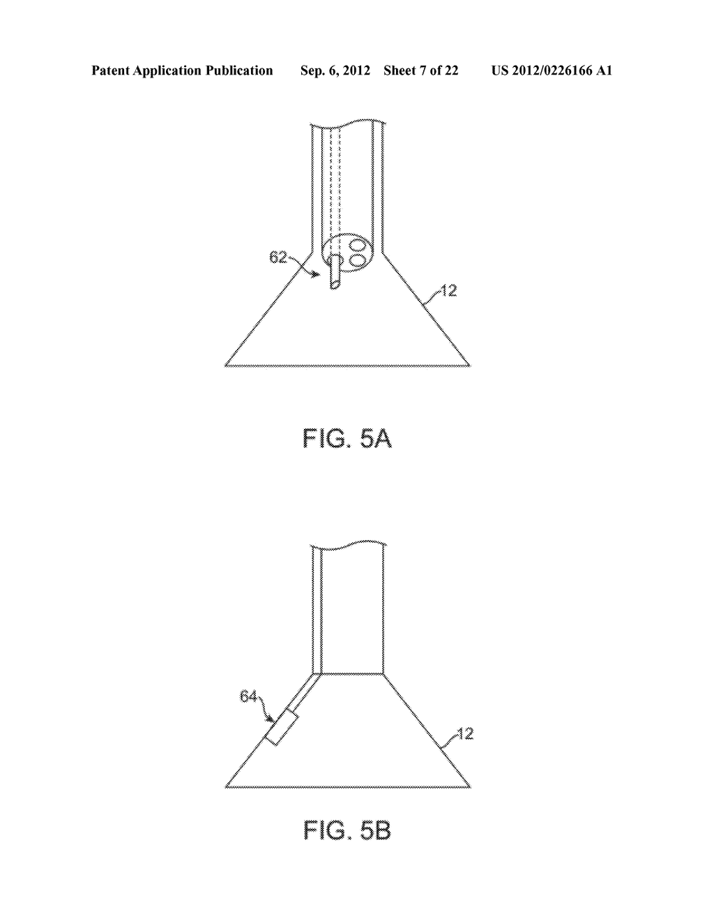 DELIVERY OF BIOLOGICAL COMPOUNDS TO ISCHEMIC AND/OR INFARCTED TISSUE - diagram, schematic, and image 08