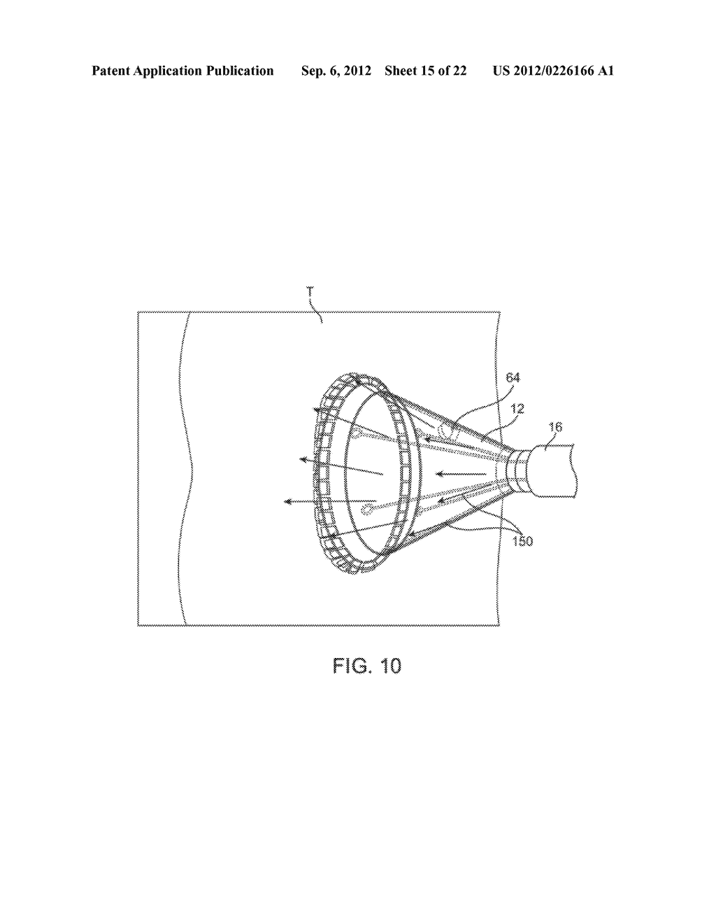 DELIVERY OF BIOLOGICAL COMPOUNDS TO ISCHEMIC AND/OR INFARCTED TISSUE - diagram, schematic, and image 16