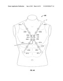 ECG LEAD WIRE ORGANIZER AND DISPENSER diagram and image