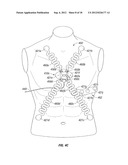 ECG LEAD WIRE ORGANIZER AND DISPENSER diagram and image