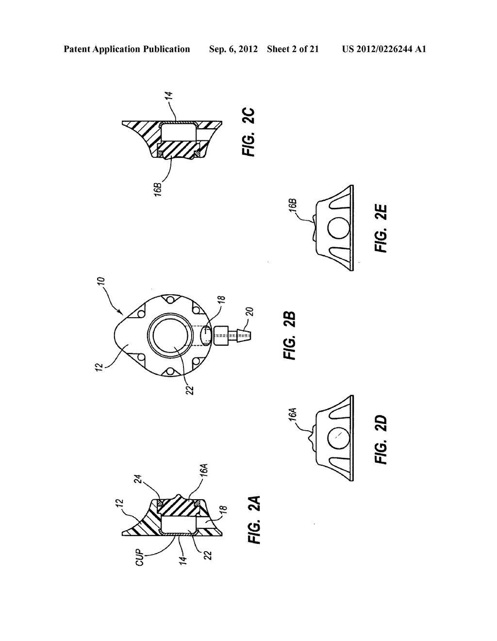 Septum Feature for Identification of an Access Port - diagram, schematic, and image 03