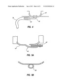 Septum Feature for Identification of an Access Port diagram and image