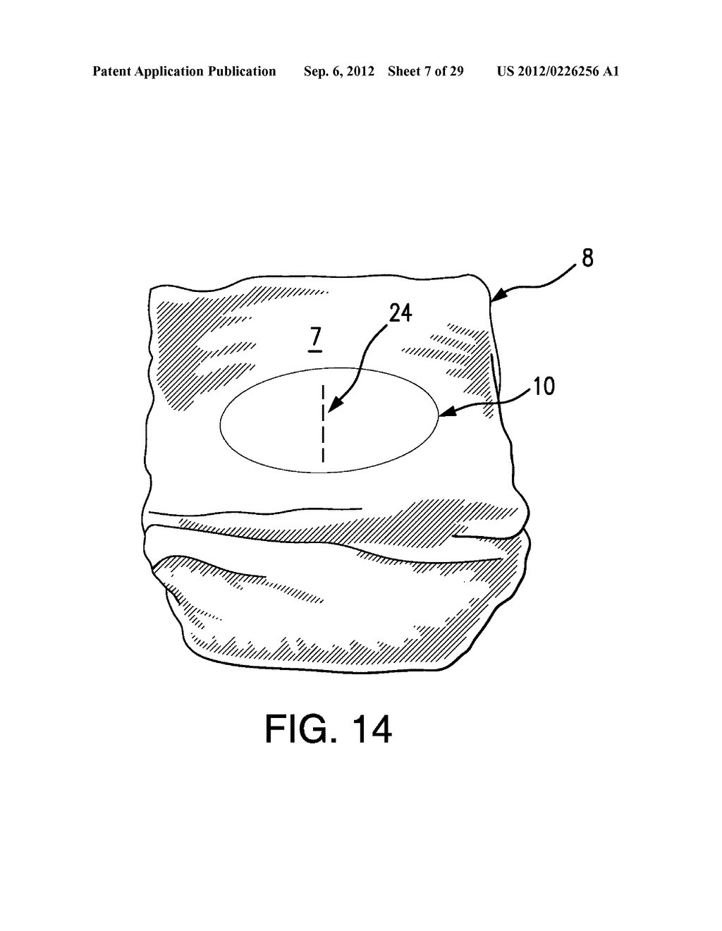 DISPOSAL BAG-SYSTEM FOR A DISPOSABLE OBJECT - diagram, schematic, and image 08