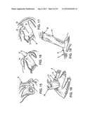 DISPOSAL BAG-SYSTEM FOR A DISPOSABLE OBJECT diagram and image