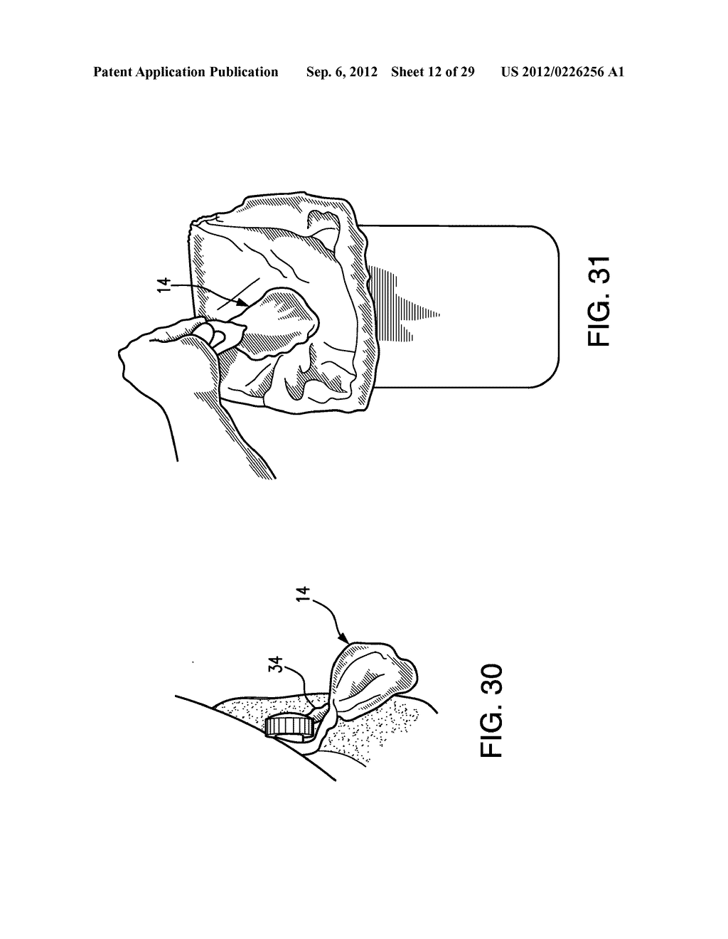 DISPOSAL BAG-SYSTEM FOR A DISPOSABLE OBJECT - diagram, schematic, and image 13