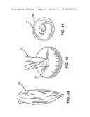 DISPOSAL BAG-SYSTEM FOR A DISPOSABLE OBJECT diagram and image