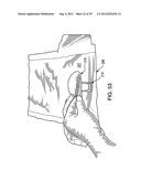 DISPOSAL BAG-SYSTEM FOR A DISPOSABLE OBJECT diagram and image