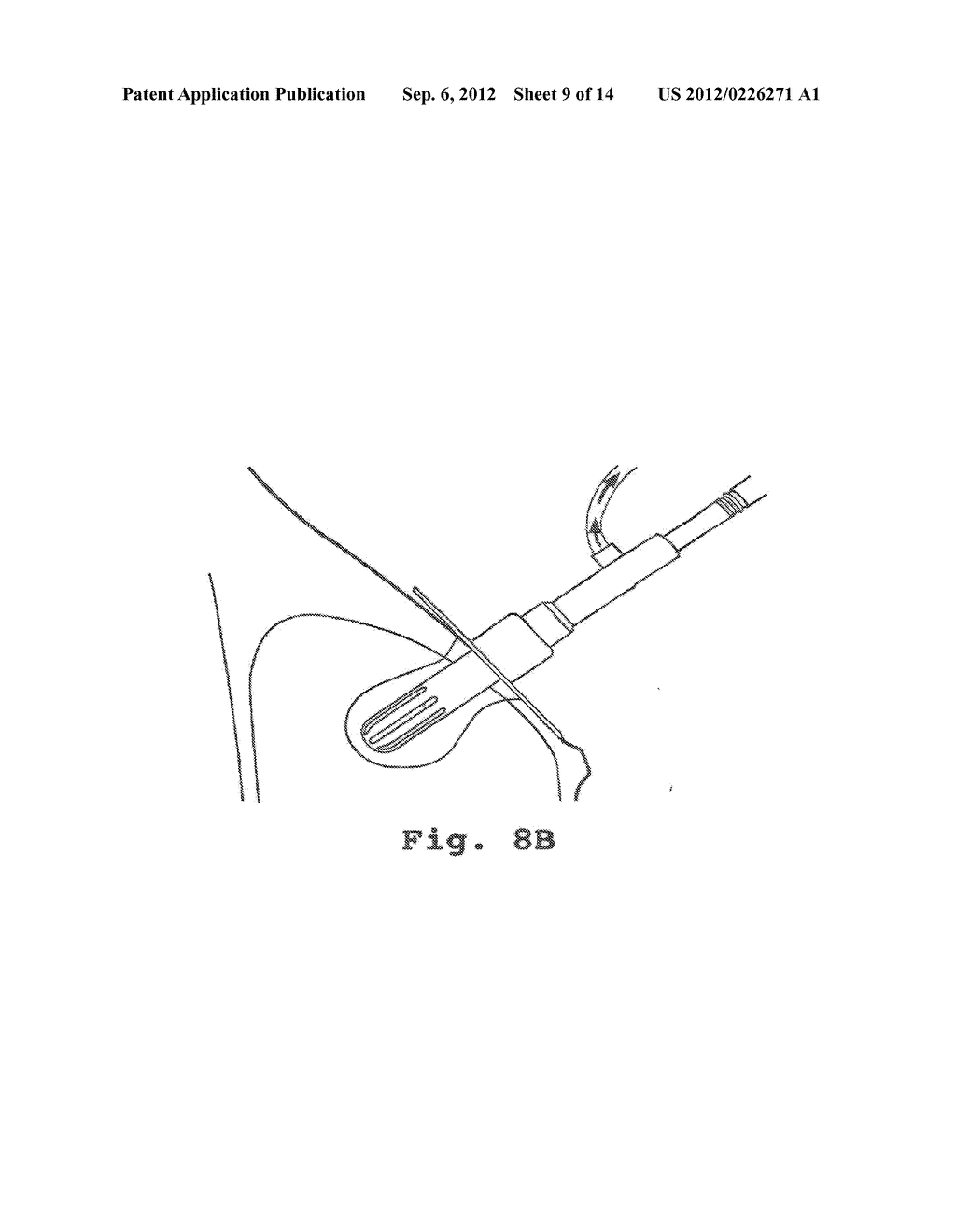 Vacuum Ablation Apparatus and Method - diagram, schematic, and image 10