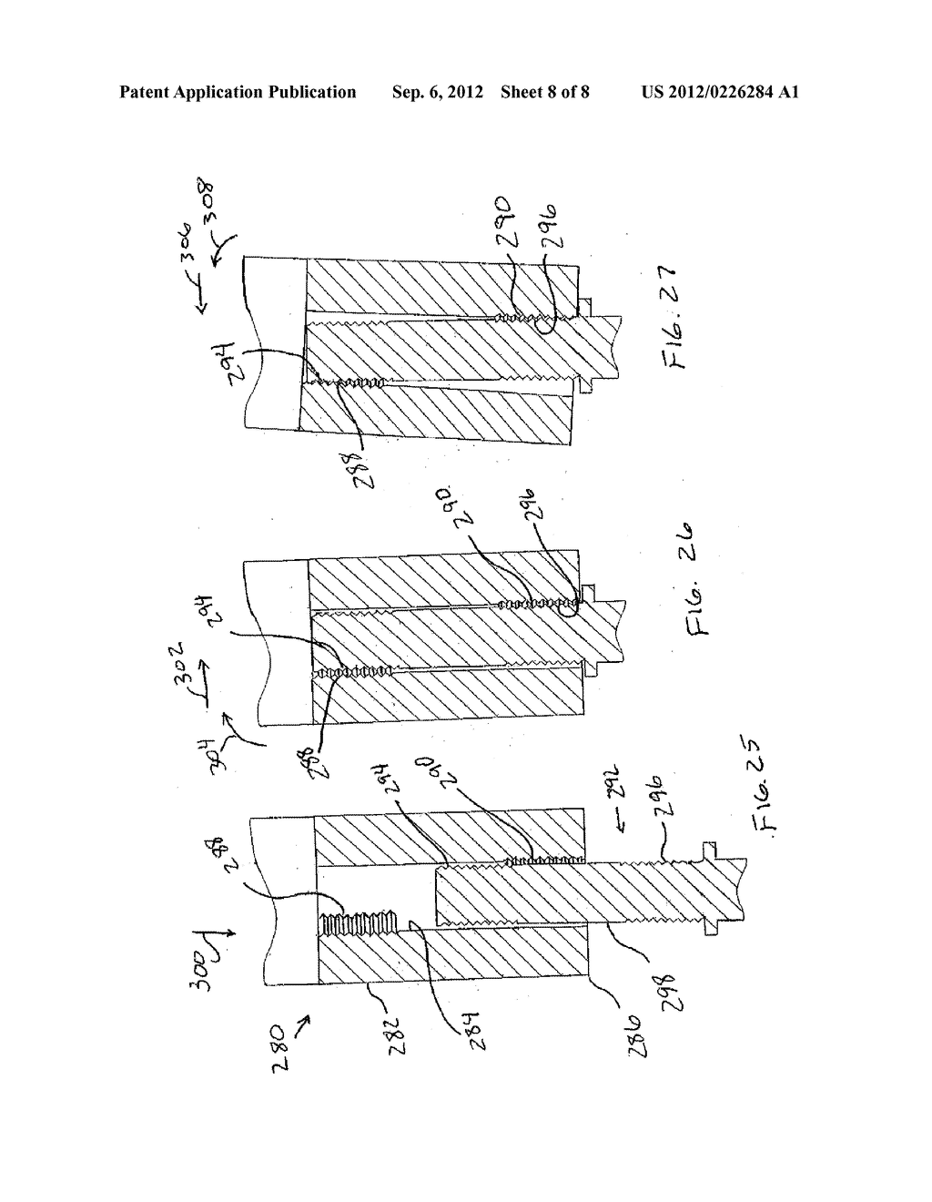 AUTOMATIC LOCKING CASPER DISTRACTOR - diagram, schematic, and image 09