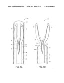 Methods and Systems for Performing Submucosal Medical Procedures diagram and image