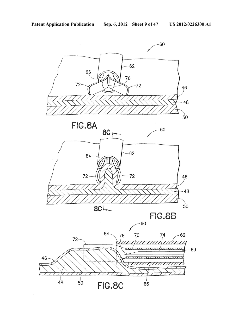 Methods and Systems for Performing Submucosal Medical Procedures - diagram, schematic, and image 10