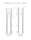 Methods and Systems for Performing Submucosal Medical Procedures diagram and image