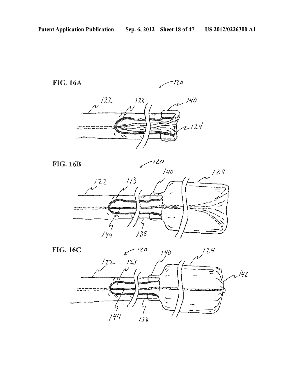 Methods and Systems for Performing Submucosal Medical Procedures - diagram, schematic, and image 19