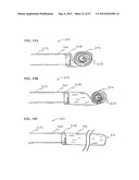 Methods and Systems for Performing Submucosal Medical Procedures diagram and image