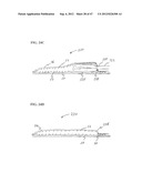 Methods and Systems for Performing Submucosal Medical Procedures diagram and image