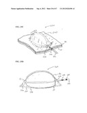 Methods and Systems for Performing Submucosal Medical Procedures diagram and image