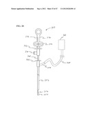 Methods and Systems for Performing Submucosal Medical Procedures diagram and image