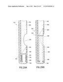 Methods and Systems for Performing Submucosal Medical Procedures diagram and image