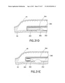 Methods and Systems for Performing Submucosal Medical Procedures diagram and image