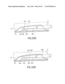 Methods and Systems for Performing Submucosal Medical Procedures diagram and image